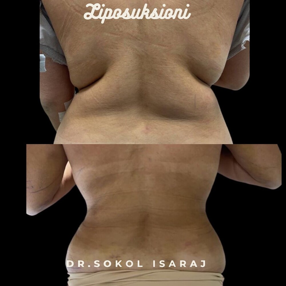 Clinic Results Gallery